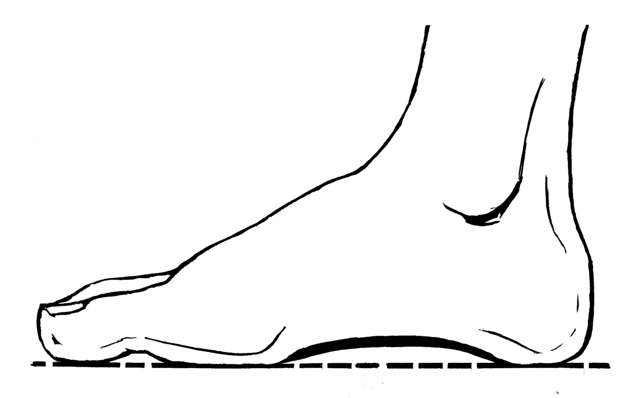 Figure 13.1 — Medial view of the foot showing the longitudinal arch with calcaneus, talus, navicular, cuneiform, and metatarsal bones forming the arch structure.