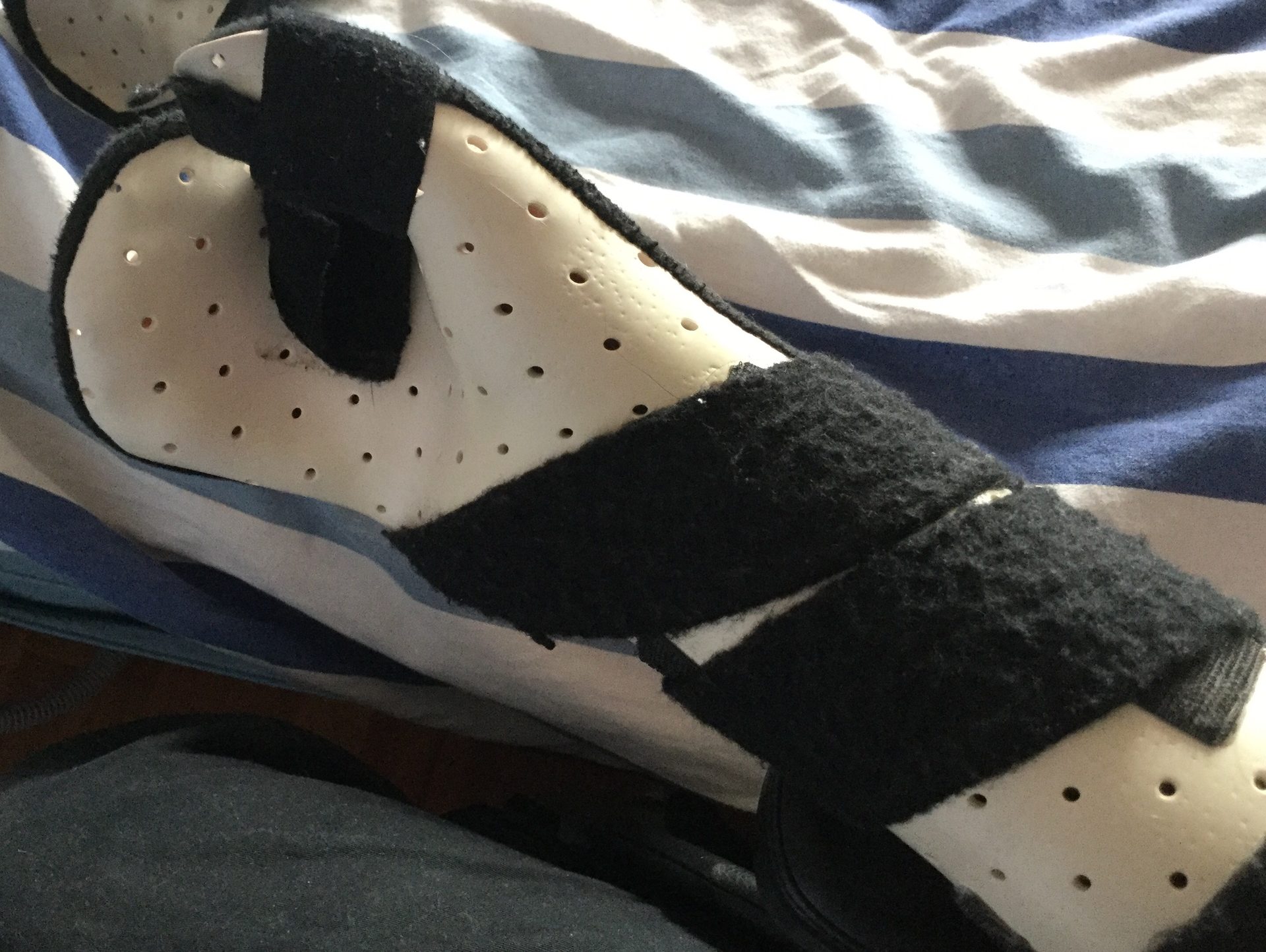 Figure 9.1 — Custom-fabricated full hand orthosis (dorsal/back view of a thermoplastic resting splint; clinical resting position requires wrist 20-30 degrees extension, MCPs 70-90 degrees flexion, IPs 15-20 degrees slight flexion, thumb midway between radial abduction and palmar opposition)