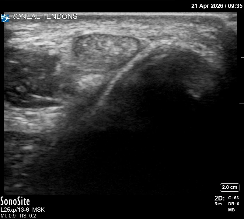The correct ultrasound view
