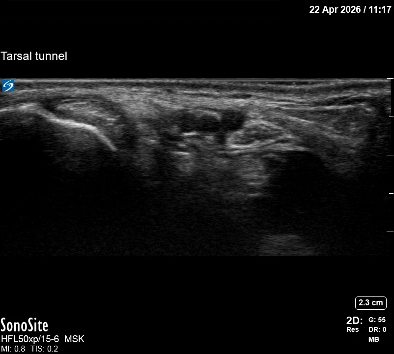 The correct ultrasound view