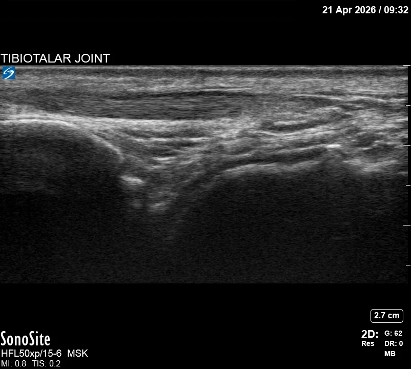 The correct ultrasound view