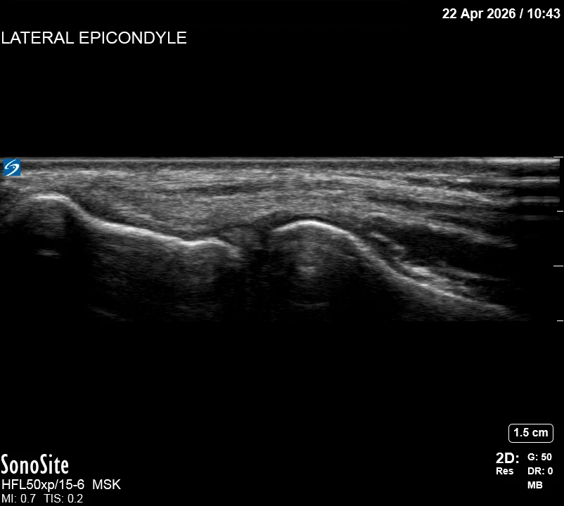 The correct ultrasound view