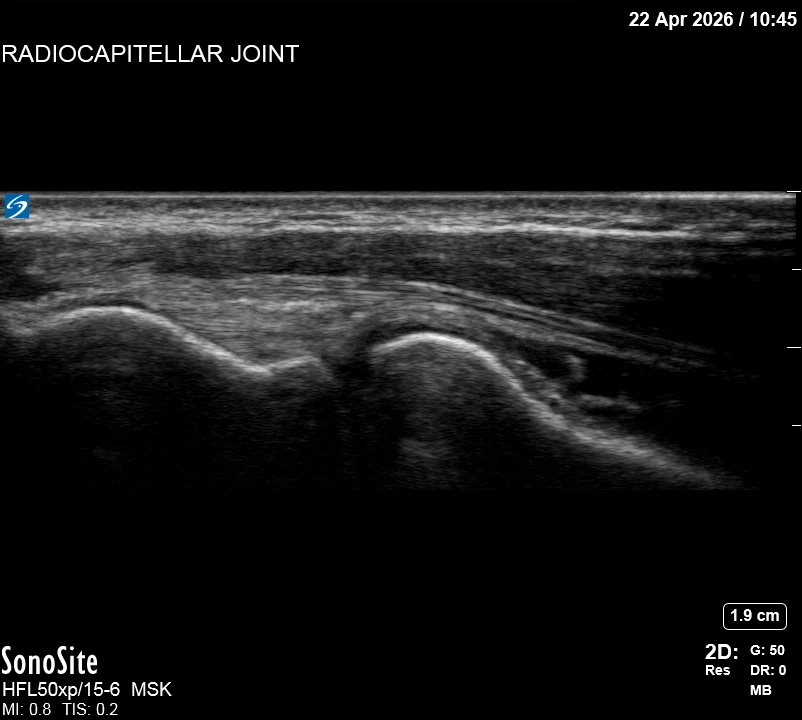 The correct ultrasound view