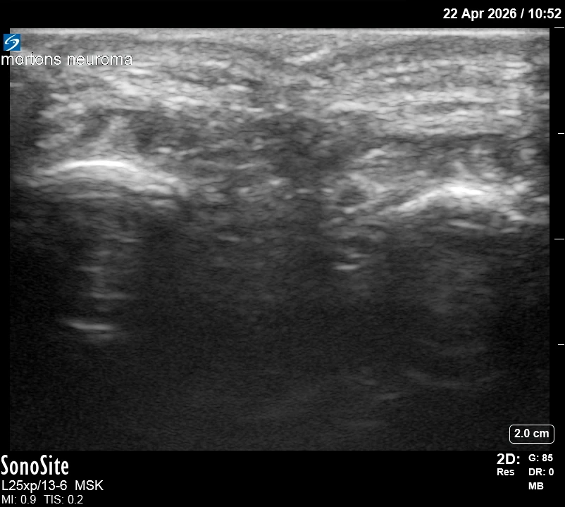 The correct ultrasound view