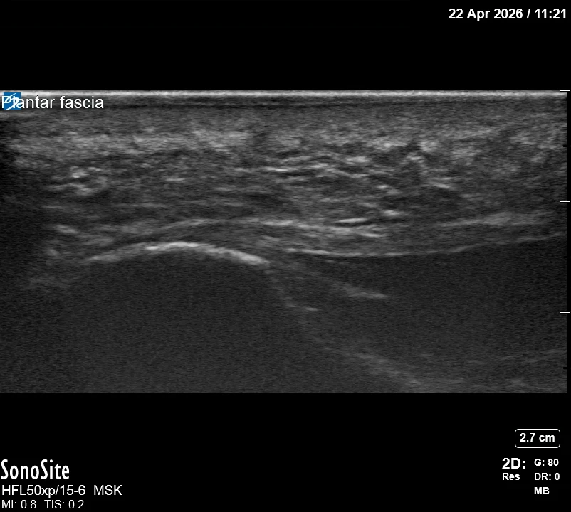 The correct ultrasound view