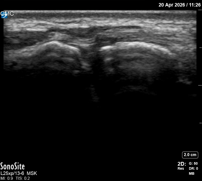 The correct ultrasound view