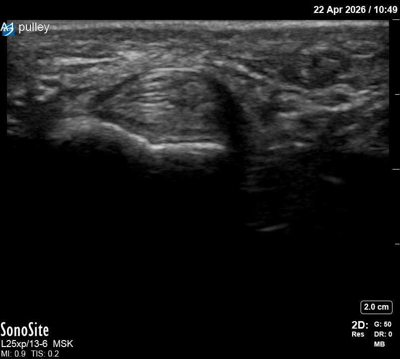 The correct ultrasound view