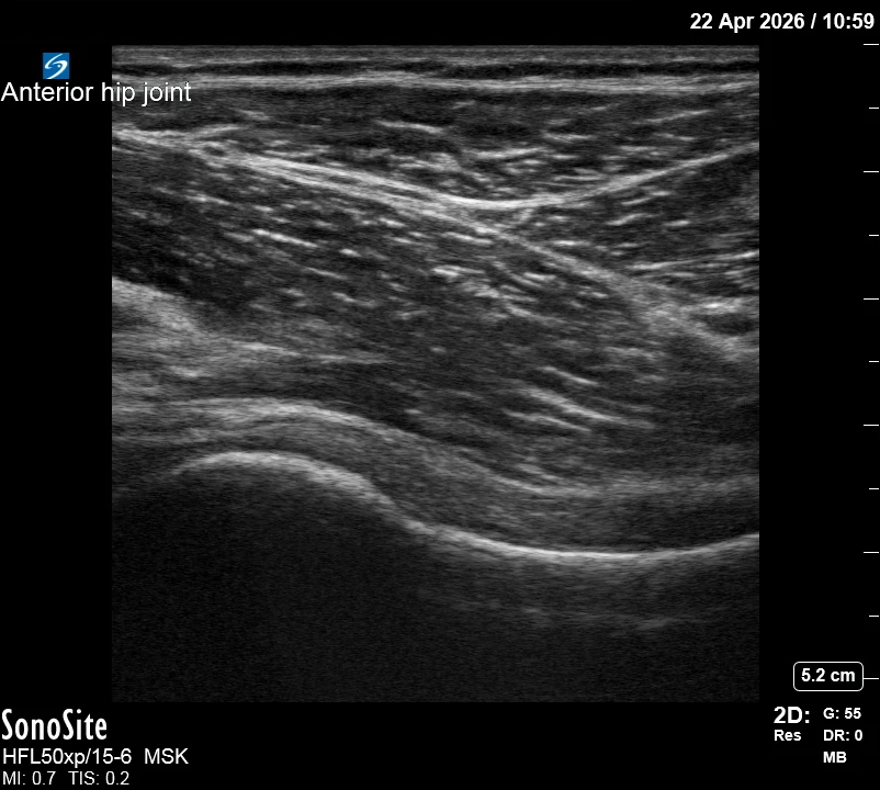 The correct ultrasound view