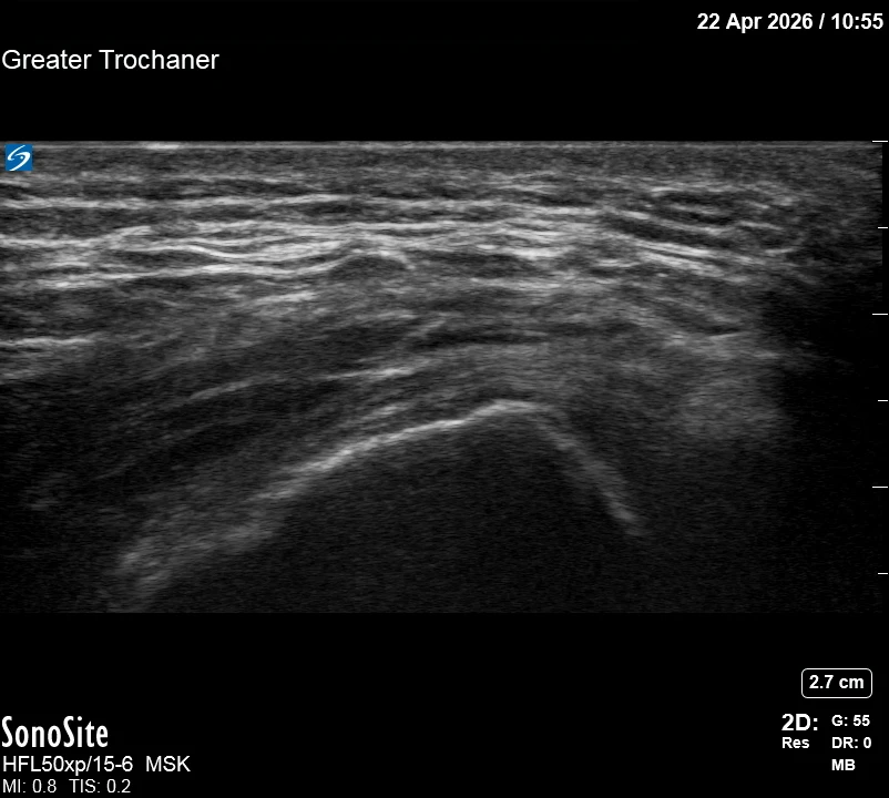The correct ultrasound view
