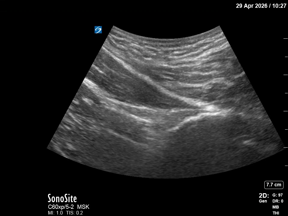 The correct ultrasound view