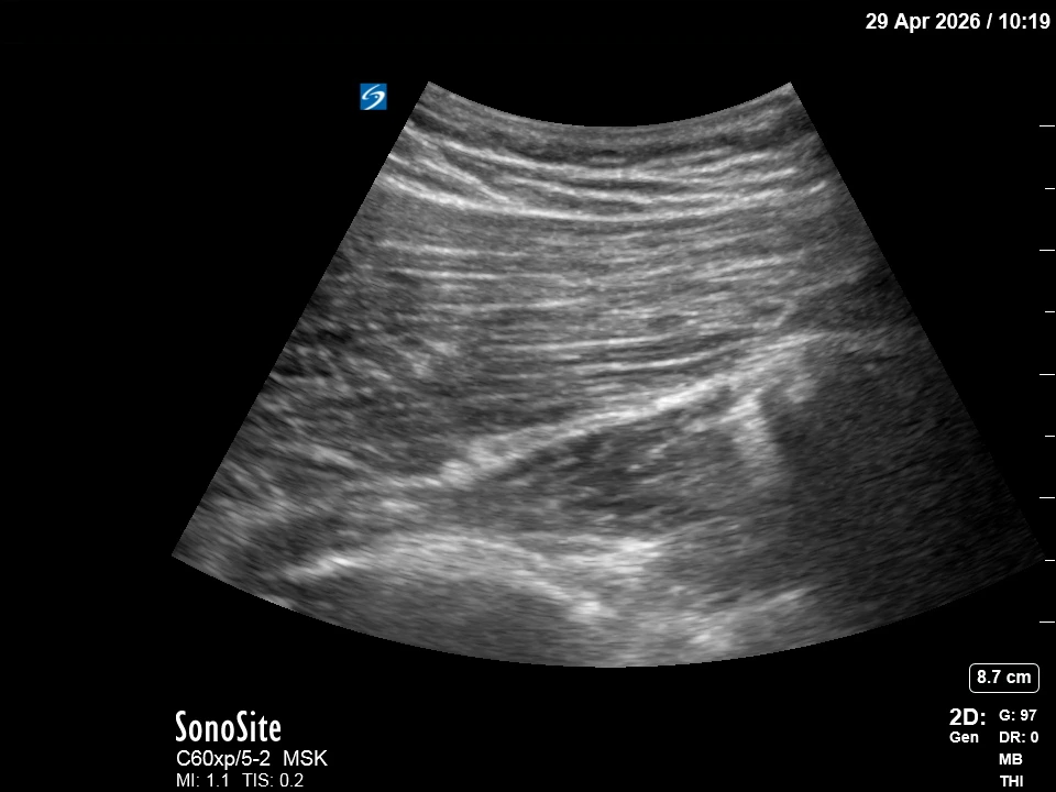 The correct ultrasound view