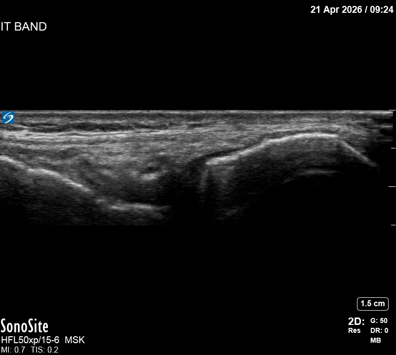The correct ultrasound view