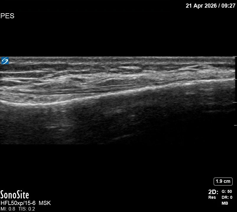The correct ultrasound view