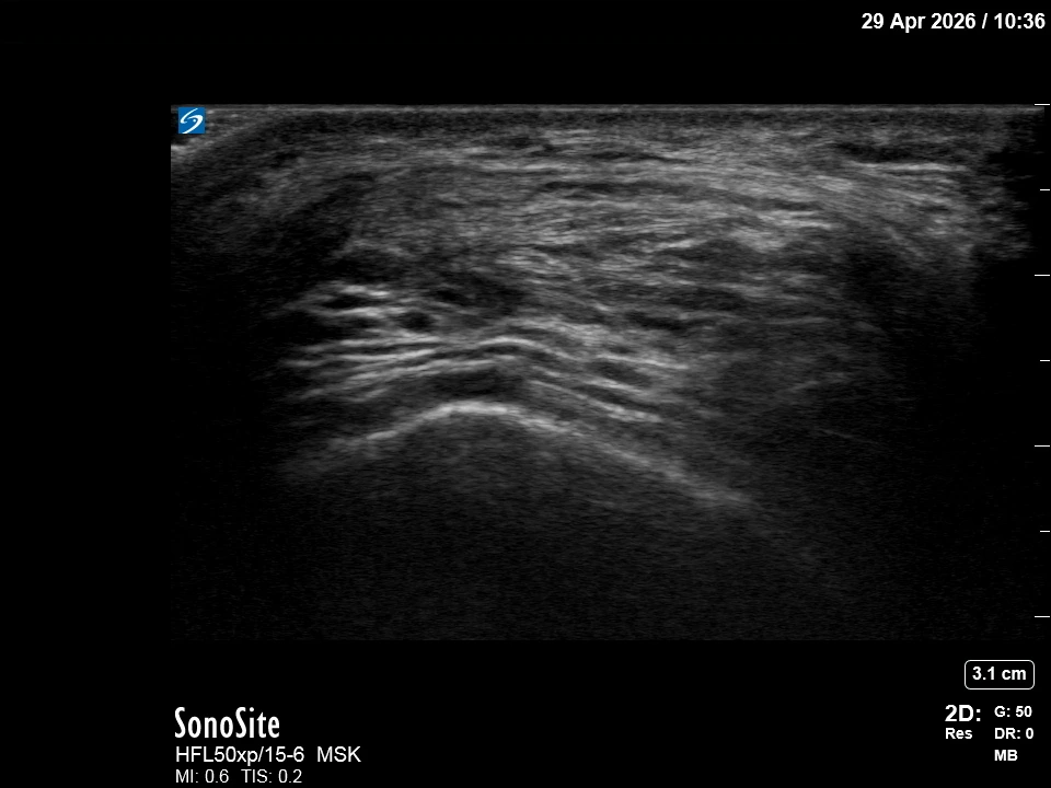 The correct ultrasound view