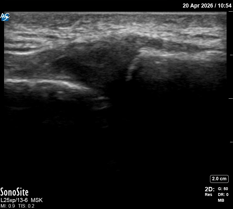 The correct ultrasound view