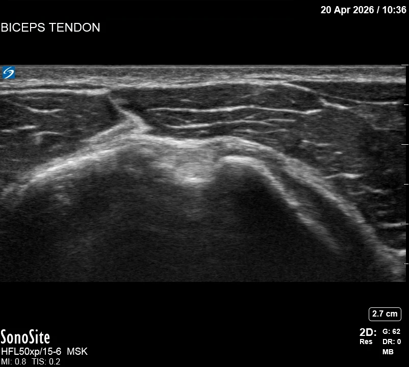 The correct ultrasound view