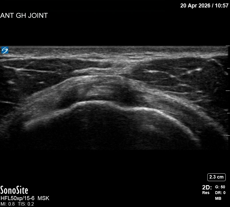 The correct ultrasound view