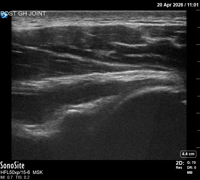 The correct ultrasound view