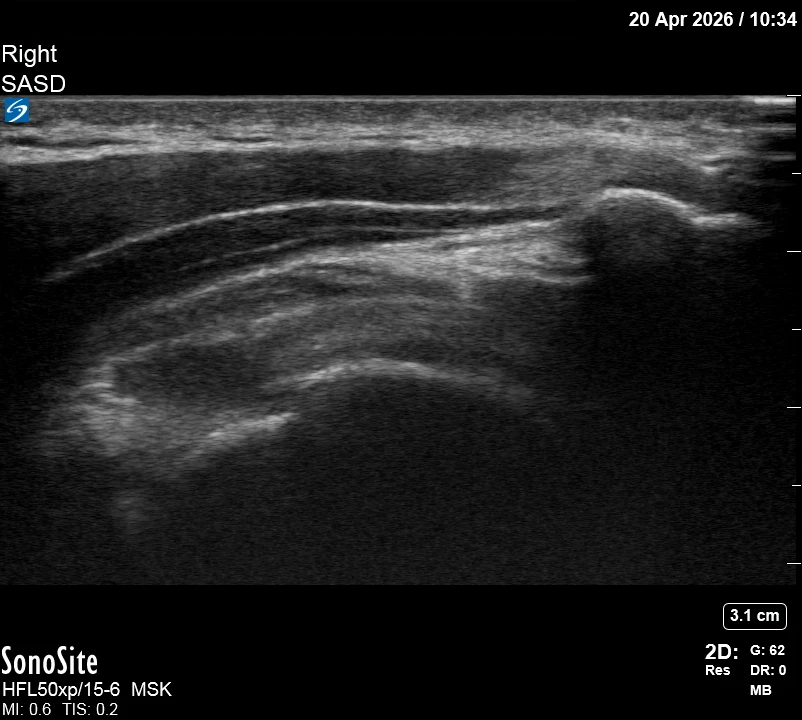 The correct ultrasound view