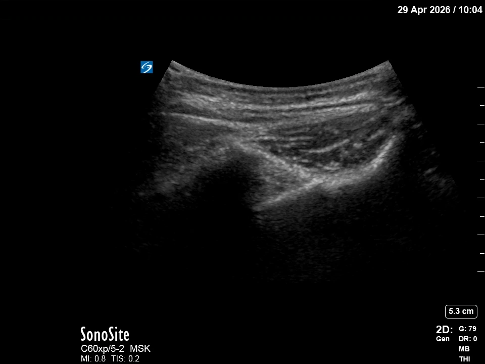 The correct ultrasound view