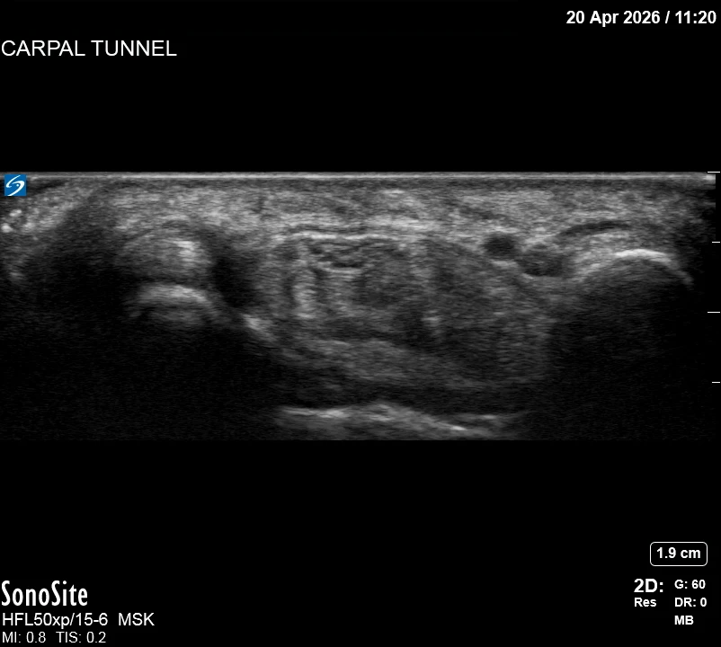 The correct ultrasound view