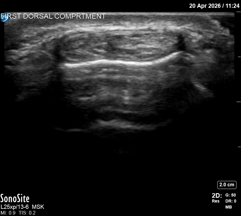 The correct ultrasound view